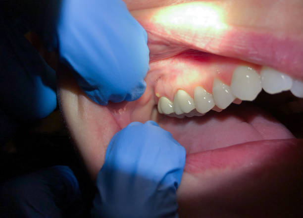 Best Urgent Tooth Repair  in Ypsilanti, MI